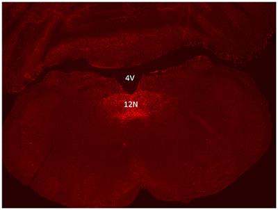 Silencing of Hypoglossal Motoneurons Leads to Sleep Disordered Breathing in Lean Mice